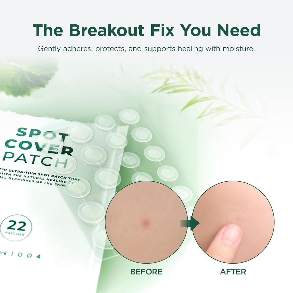 SKIN1004 acne patch applied to skin, before and after on a blemish