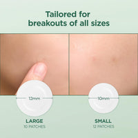 SKIN1004 acne patches in two sizes applied to skin for different breakout sizes