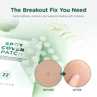 SKIN1004 acne patch applied to skin, before and after on a blemish