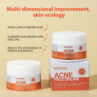 Benefits of Kazven anti-acne cream: reduces breakouts, redness, and skin marks