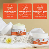 Texture of Kazven Clear Skin cream and its three key benefits for acne-prone skin